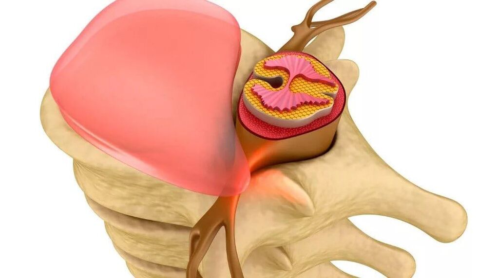 potenza ridotta a causa del cancro